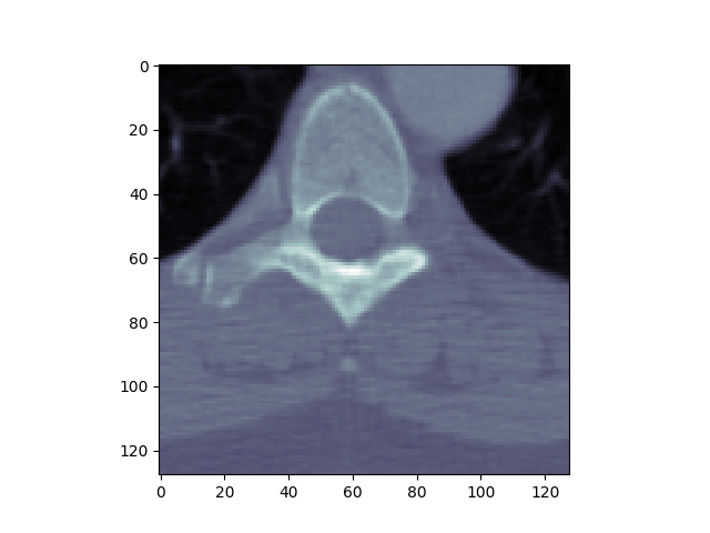 _images/sphx_glr_plot_read_dicom_0011.png