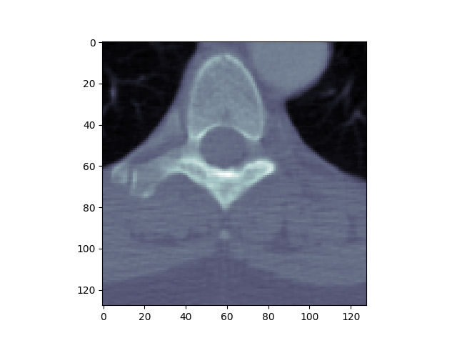 ../_images/sphx_glr_plot_read_dicom_0011.png