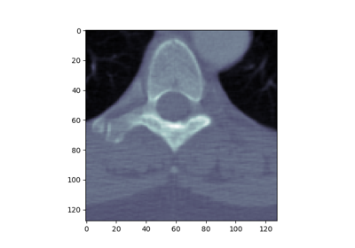 ../_images/sphx_glr_plot_read_dicom_thumb.png