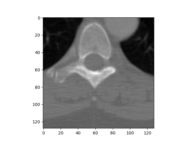 plot read dicom