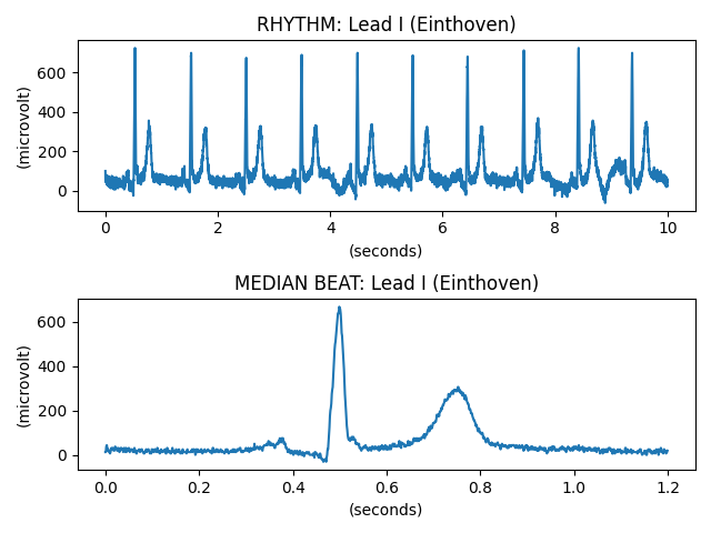 RHYTHM: Lead I (Einthoven), MEDIAN BEAT: Lead I (Einthoven)